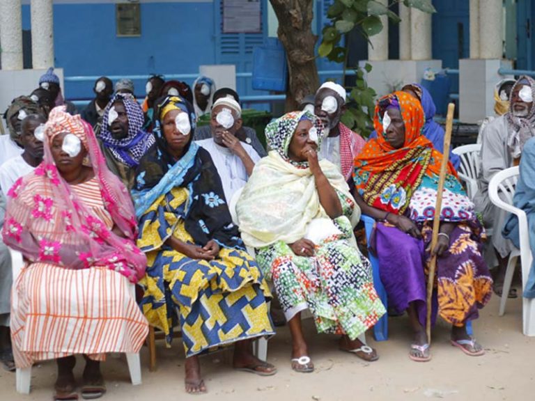 Santé   oculaire :1000 cas de cataracte à opérer en 5 jours à Yeumbeul grâce à l’appui de Direct Aid